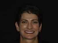 Konig Center for Cosmetic & Comprehensive Dentistry smile photos